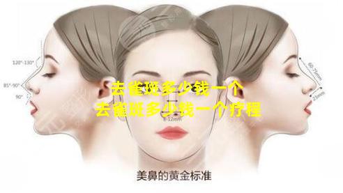 去雀斑多少钱一个 去雀斑多少钱一个疗程